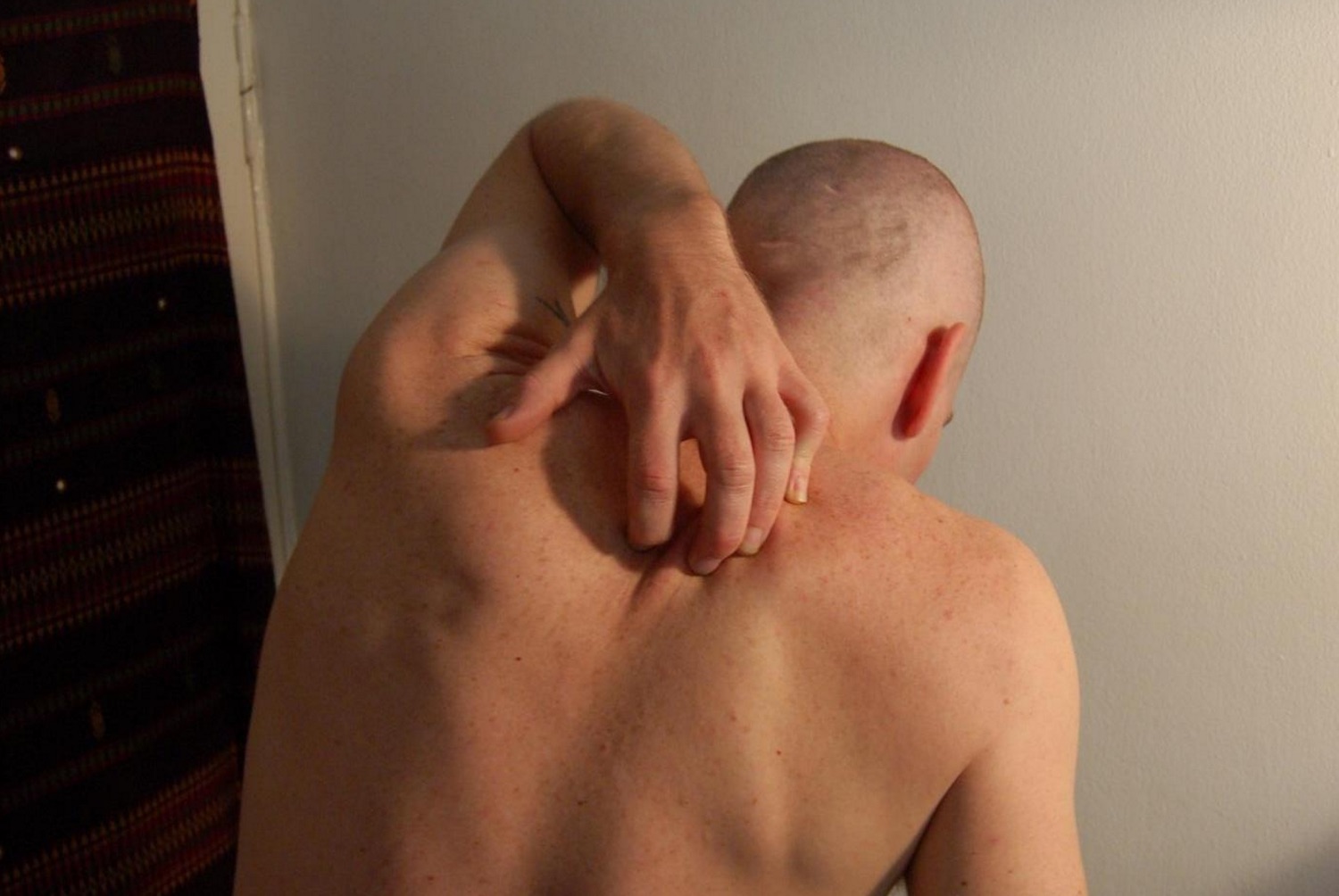 Psoriasis Is On The Skin, But Starts From Within